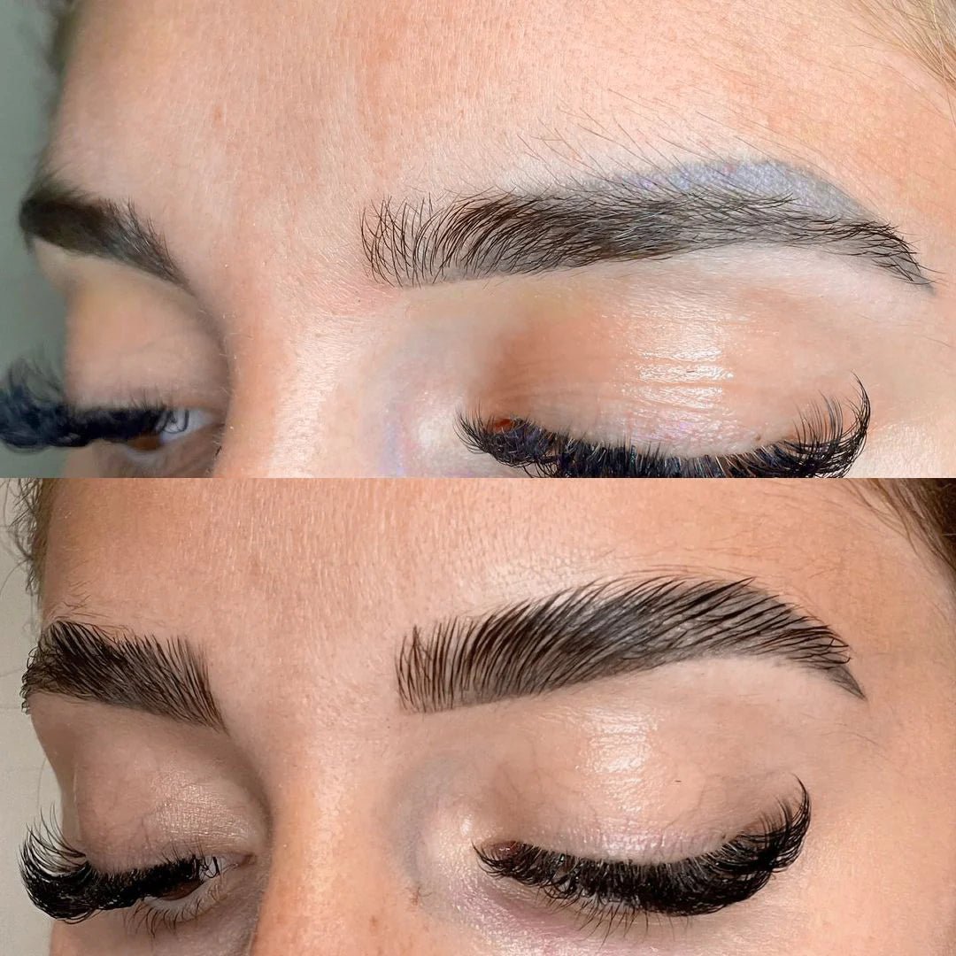Kit Browlift