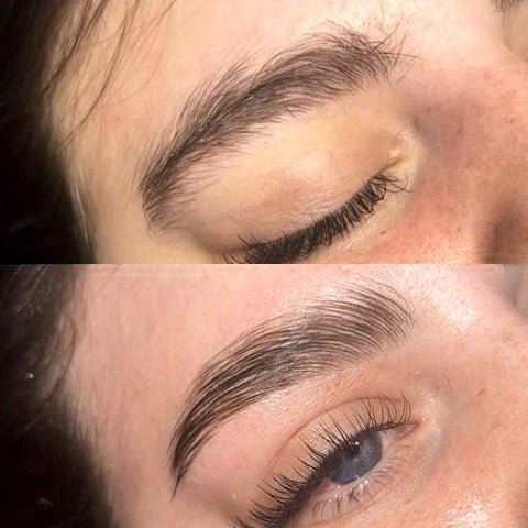 Kit Browlift