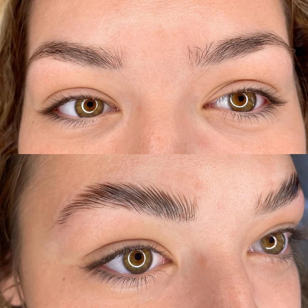 Kit Browlift