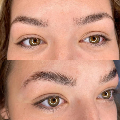 Kit Browlift